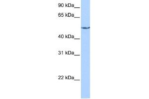 WB Suggested Anti-CRAT Antibody Titration: 0. (CRAT antibody  (N-Term))