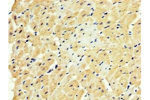 IHC image of ABIN7152350 diluted at 1:500 and staining in paraffin-embedded human heart tissue performed on a Leica BondTM system. (SOD3 antibody  (AA 19-160))