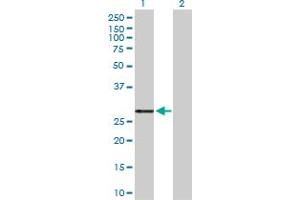 Western Blot analysis of PRSS2 expression in transfected 293T cell line by PRSS2 MaxPab polyclonal antibody. (PRSS2 antibody  (AA 1-247))