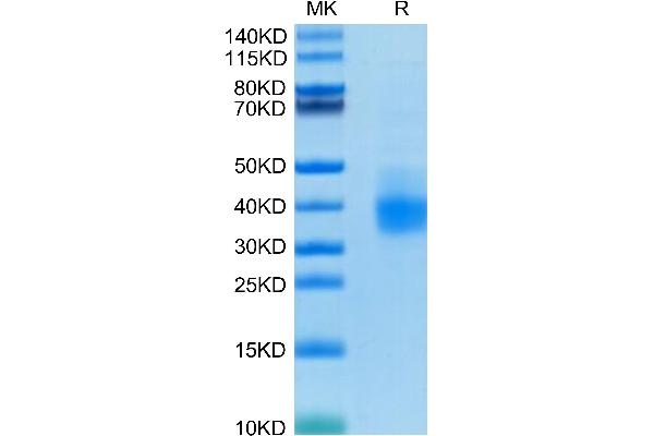 PD-L1 Protein (AA 19-238) (His tag)