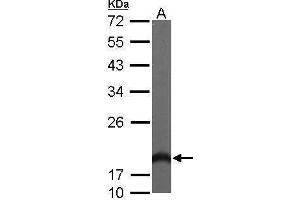WB Image Sample (50 ug of whole cell lysate) A: Mouse brain 12% SDS PAGE antibody diluted at 1:1000 (HPCAL1 antibody)
