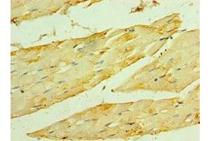 Immunohistochemistry of paraffin-embedded human skeletal muscle tissue using ABIN7154911 at dilution of 1:100 (HSPB2 antibody  (AA 1-182))