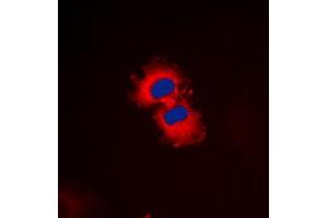 Immunofluorescent analysis of ZAK staining in HeLa cells. (ZAK antibody  (C-Term))