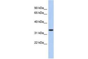 Image no. 1 for anti-Aspartoacylase (ASPA) (AA 71-120) antibody (ABIN6743962) (ASPA antibody  (AA 71-120))