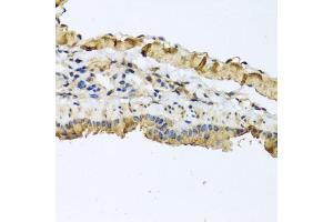Immunohistochemistry of paraffin-embedded mouse lung using ATP2C1 antibody (ABIN5975353) at dilution of 1/100 (40x lens).