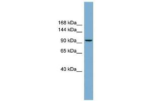 PPP1R3A antibody used at 1 ug/ml to detect target protein. (PPP1R3A antibody)