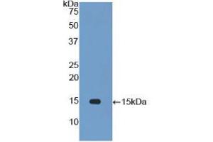 Western blot analysis of recombinant Rat IL34. (IL-34 antibody  (AA 21-234))