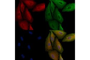 ABIN6264833 and ABIN6279044 staining  cells by IF/ICC. (RPL29 antibody  (Internal Region))