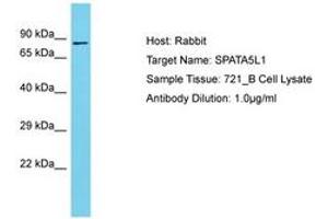 Image no. 1 for anti-Spermatogenesis Associated 5-Like 1 (SPATA5L1) (AA 580-629) antibody (ABIN6750664) (SPATA5L1 antibody  (AA 580-629))