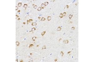 Immunohistochemistry of paraffin-embedded mouse brain using MCL1 Rabbit pAb (ABIN3020787, ABIN3020788, ABIN3020789 and ABIN6213724) at dilution of 1:100 (40x lens). (MCL-1 antibody  (AA 120-220))