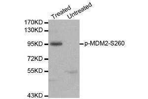 Western blot analysis of extracts of 293 cell line, using phospho-MDM2-S260 antibody (ABIN5969919). (MDM2 antibody  (pSer260))