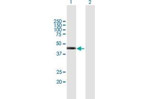 Western Blot analysis of TSPY2 expression in transfected 293T cell line by TSPY2 MaxPab polyclonal antibody. (TSPY2 antibody  (AA 1-308))