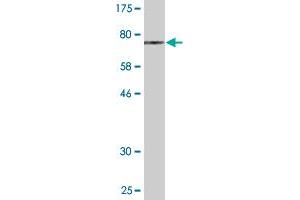 Western Blot detection against Immunogen (70. (PIP4K2A antibody  (AA 1-406))