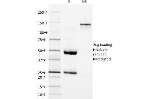 SDS-PAGE (SDS) image for anti-Epidermal Growth Factor Receptor (EGFR) antibody (ABIN6939295)
