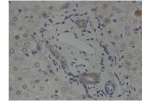Sample Type:  Human Bile DuctPrimary   Dilution:  1:500 (GLIS2 antibody  (N-Term))