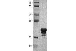 Validation with Western Blot (FGF21 Protein (His tag))