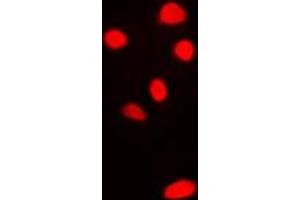 Immunofluorescent analysis of RPL11 staining in H9C2 cells. (RPL11 antibody  (C-Term))