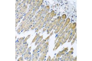 Immunohistochemistry of paraffin-embedded mouse stomach using NDUFB10 antibody (ABIN5972156) at dilution of 1/100 (40x lens). (NDUFB10 antibody)