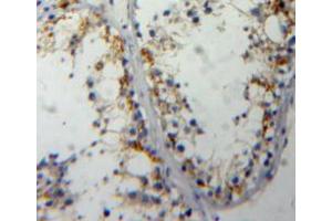 Used in DAB staining on fromalin fixed paraffin-embedded testis tissue (Cdc25 antibody  (AA 376-524))