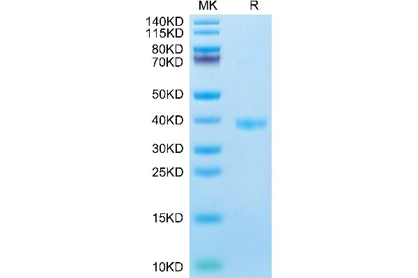 F11R Protein (AA 27-238) (His tag)