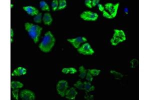 DAB2IP antibody  (AA 85-100)