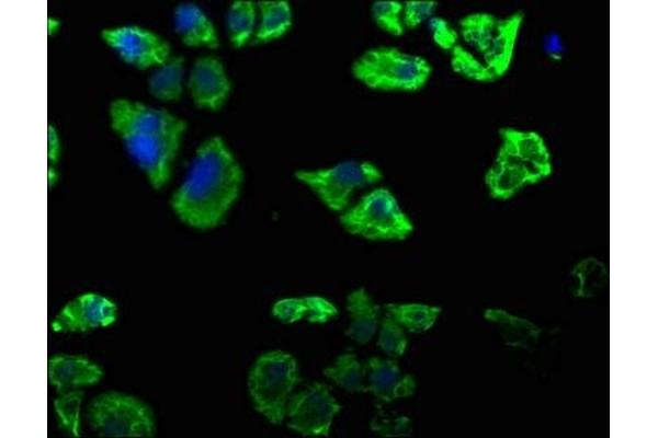 DAB2IP antibody  (AA 85-100)