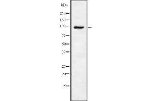 Western blot analysis of TRPV4 using HeLa whole cell lysates (TRPV4 antibody  (C-Term))