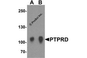 Western Blotting (WB) image for anti-Protein tyrosine Phosphatase, Receptor Type, D (PTPRD) (N-Term) antibody (ABIN1031529) (PTPRD antibody  (N-Term))
