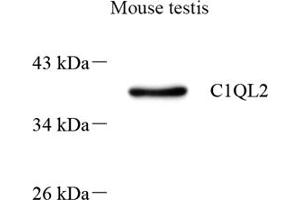 Western blot analysis of C1QL2 (ABIN7073561) at dilution of 1: 500 (C1QL2 antibody)