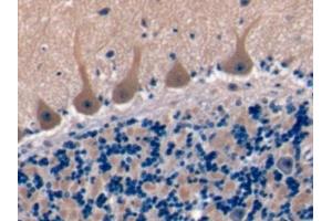 Detection of TSPAN1 in Human Cerebellum Tissue using Polyclonal Antibody to Tetraspanin 1 (TSPAN1) (TSPAN1 antibody  (AA 112-215))