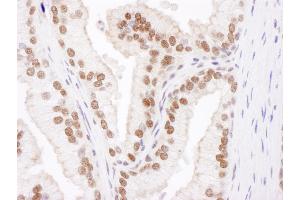 Immunohistochemistry (IHC) image for anti-Cullin 4B (CUL4B) (AA 863-913) antibody (ABIN7454566)