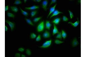 Immunofluorescence staining of A549 cells with ABIN7144534 at 1:166, counter-stained with DAPI. (ALOX15B antibody  (AA 1-676))