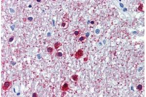 Human Brain, Cerebellum (formalin-fixed, paraffin-embedded) stained with ONECUT1 antibody ABIN462211 followed by biotinylated goat anti-rabbit IgG secondary antibody ABIN481713, alkaline phosphatase-streptavidin and chromogen. (ONECUT1 antibody  (C-Term))