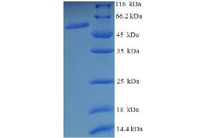 SDS-PAGE (SDS) image for MON1 Homolog A (MON1A) (AA 205-555), (partial) protein (His-SUMO Tag) (ABIN5711493)