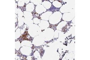 Immunohistochemical staining of human bone marrow with MEIG1 polyclonal antibody  shows strong cytoplasmic and nuclear positivity in subsets of hematopoietic cells at 1:200-1:500 dilution. (MEIG1 antibody)