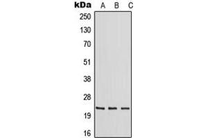 Western blot analysis of RAB30 expression in HeLa (A), mouse liver (B), rat liver (C) whole cell lysates. (RAB30 antibody  (Center))
