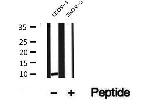 Western blot analysis of extracts of SKOV-3 cells, using SRP9 antibody.