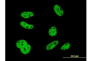 Immunofluorescence of monoclonal antibody to ELAVL1 on HeLa cell. (ELAVL1 antibody  (AA 1-100))