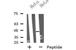 Western blot analysis of extracts from HeLa cells, using MTLR antibody. (Motilin Receptor antibody  (C-Term))
