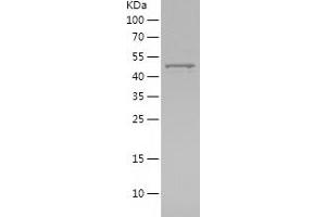 Western Blotting (WB) image for Matrix Metallopeptidase 13 (Collagenase 3) (MMP13) (AA 266-471) protein (His-IF2DI Tag) (ABIN7282432) (MMP13 Protein (AA 266-471) (His-IF2DI Tag))