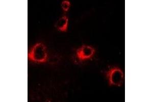 Immunofluorescent analysis of CD158b2 staining in HepG2 cells. (KIR2DL3 antibody)