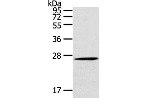 Western Blotting (WB) image for anti-C-Type Lectin Domain Family 4, Member A (CLEC4A) antibody (ABIN2421480) (CLEC4A antibody)