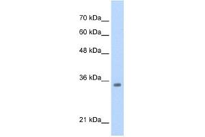WB Suggested Anti-TCF4 Antibody  Titration: 0. (TCF4 antibody  (N-Term))