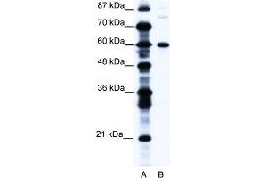 WB Suggested Anti-CNOT3 Antibody   Titration: 1. (CNOT3 antibody  (N-Term))