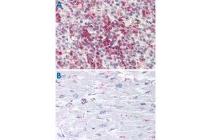 Immunohistochemistry (Formalin/PFA-fixed paraffin-embedded sections) of human spleen (A) and human heart tissue (B) with CYSLTR2 polyclonal antibody . (CasLTR2 antibody  (C-Term))