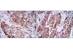 Immunohistochemistry (IHC) image for anti-Heat Shock Protein 90kDa alpha (Cytosolic), Class A Member 1 (HSP90AA1) antibody (ABIN1107606) (HSP90AA1 antibody)