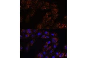 Immunofluorescence analysis of  cells using TMED3 antibody (ABIN7270944) at dilution of 1:100.
