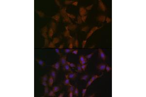 Immunofluorescence analysis of C6 cells using DISC1 Rabbit mAb (ABIN7266799) at dilution of 1:100 (40x lens).