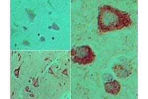 Image no. 1 for anti-Toll-Like Receptor Adaptor Molecule 2 (TICAM2) (AA 150-200) antibody (ABIN960372) (TICAM2 antibody  (AA 150-200))