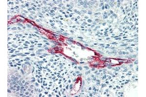Immunohistochemistry (IHC) image for anti-Coagulation Factor VIII (F8) antibody (ABIN614478) (Factor VIII antibody)